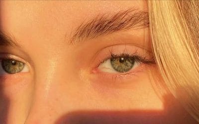 ¿Cómo afecta el sol a tus ojos en verano?